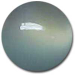 Chalcedony